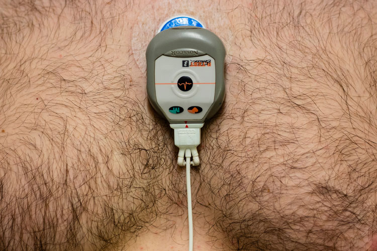 7 day ECG monitor 