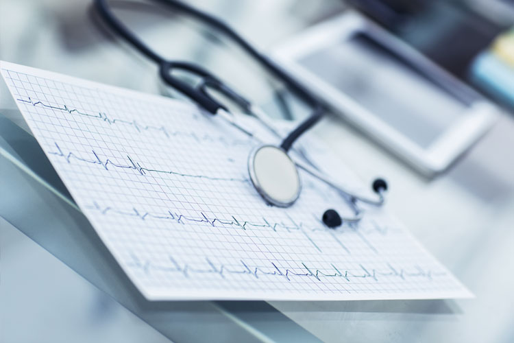 ECG (electrocardiogram)