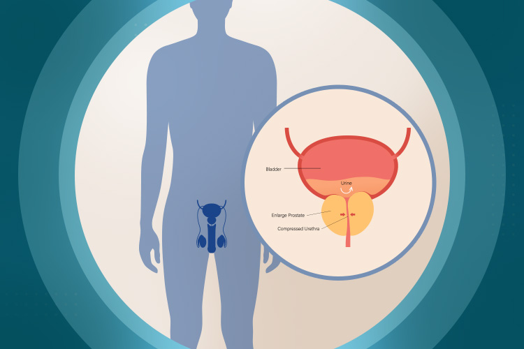 Advice regarding erectile dysfunction, prostate issues and hair loss